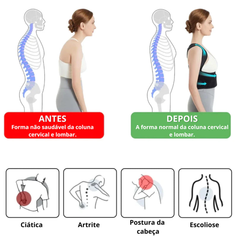 Corretor Postural Ortopédico Coluna Cervical Unissex